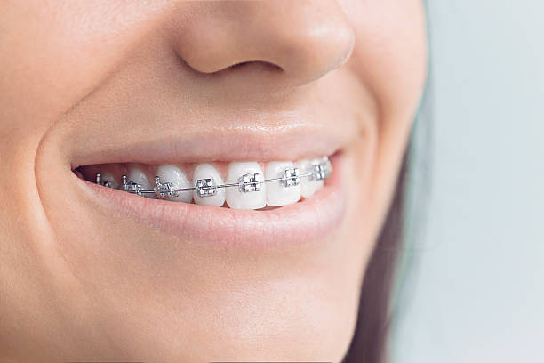 Best Invisalign and Clear Aligners  in Gunter, TX